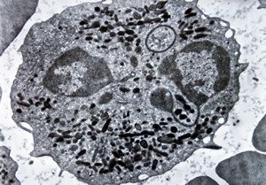 F,61y. | blood - neutrophilic granulocyte F,61y. | blood - neutrophilic granulocyte